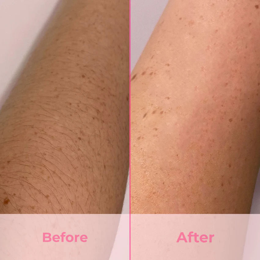 Eteera IPL Pro