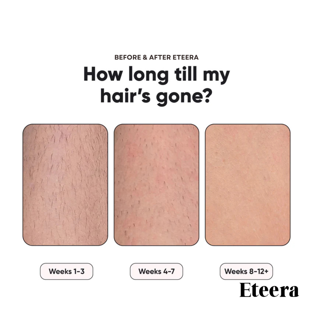 Eteera IPL Pro